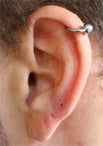 Ear with a silver-tone ball hoop in the upper helix
